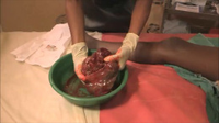 Examining the Placenta